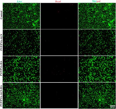 Multifunctional electrospun nanofibrous scaffold enriched with alendronate and hydroxyapatite for balancing osteogenic and osteoclast activity to promote bone regeneration